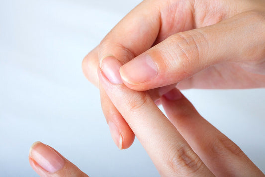 Mão feminina mostrando unha descamada e quebradiça, ilustrando a importância do cuidado interno com vitaminas para unhas fracas.